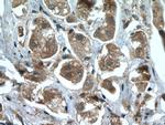 ARHGAP27 Antibody in Immunohistochemistry (Paraffin) (IHC (P))