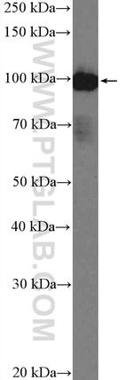 ARHGAP27 Antibody in Western Blot (WB)