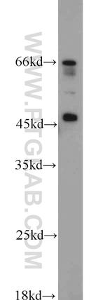 PRDM7 Antibody in Western Blot (WB)