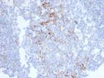 CD23 (Fc Epsilon RII) Antibody in Immunohistochemistry (Paraffin) (IHC (P))