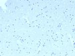 CD23 (Fc Epsilon RII) Antibody in Immunohistochemistry (Paraffin) (IHC (P))