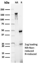 CD23 (Fc Epsilon RII) Antibody in SDS-PAGE (SDS-PAGE)