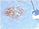 CD23 (Fc Epsilon RII) Antibody in Immunohistochemistry (Paraffin) (IHC (P))