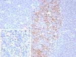 CD23 (Fc Epsilon RII) Antibody in Immunohistochemistry (Paraffin) (IHC (P))