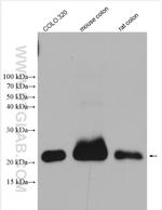 PPP1R14D Antibody in Western Blot (WB)