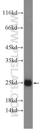PPP1R14D Antibody in Western Blot (WB)