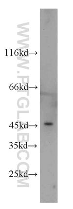 FOXD4L6 Antibody in Western Blot (WB)