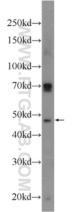 FOXD4L6 Antibody in Western Blot (WB)