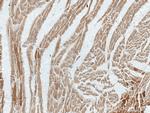 MYOM1 Antibody in Immunohistochemistry (Paraffin) (IHC (P))
