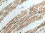 MYOM1 Antibody in Immunohistochemistry (Paraffin) (IHC (P))