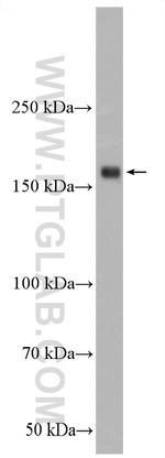 MYOM1 Antibody in Western Blot (WB)