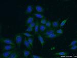 DULLARD Antibody in Immunocytochemistry (ICC/IF)