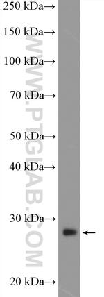 DULLARD Antibody in Western Blot (WB)