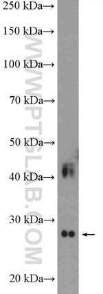 DULLARD Antibody in Western Blot (WB)