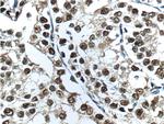 androgen receptor Antibody in Immunohistochemistry (Paraffin) (IHC (P))