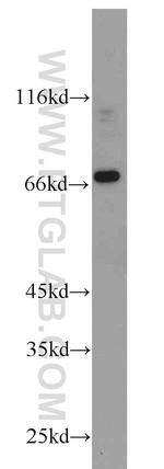androgen receptor Antibody in Western Blot (WB)