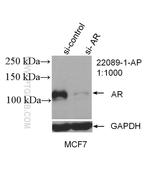 androgen receptor Antibody in Western Blot (WB)