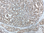 androgen receptor Antibody in Immunohistochemistry (Paraffin) (IHC (P))