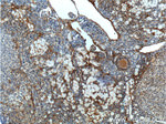 androgen receptor Antibody in Immunohistochemistry (Paraffin) (IHC (P))
