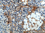 androgen receptor Antibody in Immunohistochemistry (Paraffin) (IHC (P))