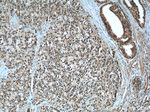 androgen receptor Antibody in Immunohistochemistry (Paraffin) (IHC (P))