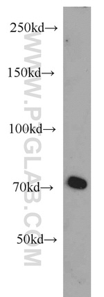 androgen receptor Antibody in Western Blot (WB)