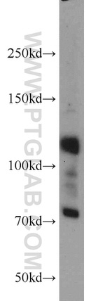 androgen receptor Antibody in Western Blot (WB)