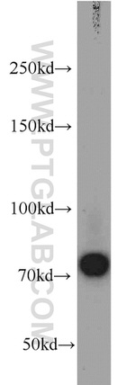 androgen receptor Antibody in Western Blot (WB)