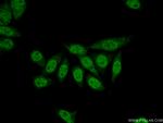 TLE3 Antibody in Immunocytochemistry (ICC/IF)