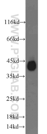 Podoplanin Antibody in Western Blot (WB)