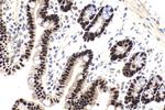 CDX2 Antibody in Immunohistochemistry (Paraffin) (IHC (P))