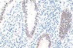 CDX2 Antibody in Immunohistochemistry (Paraffin) (IHC (P))