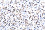 CDX2 Antibody in Immunohistochemistry (Paraffin) (IHC (P))