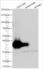 CDX2 Antibody in Western Blot (WB)
