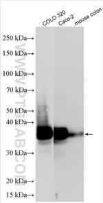 CDX2 Antibody in Western Blot (WB)