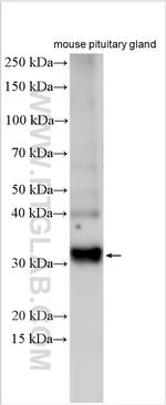 POMC Antibody in Western Blot (WB)