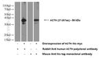 POMC Antibody in Western Blot (WB)