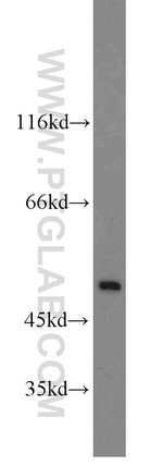 RBM22 Antibody in Western Blot (WB)