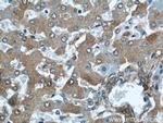 ALDH1A1 Antibody in Immunohistochemistry (Paraffin) (IHC (P))