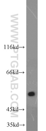 ALDH1A1 Antibody in Western Blot (WB)