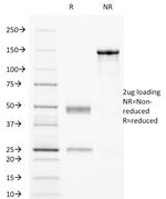 CD32 (Fc Gamma RIIa) Monoclonal Antibody (8.7)