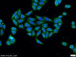 SLAIN1 Antibody in Immunocytochemistry (ICC/IF)