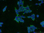 SLAIN1 Antibody in Immunocytochemistry (ICC/IF)