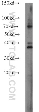SLAIN1 Antibody in Western Blot (WB)