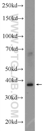SLAIN1 Antibody in Western Blot (WB)