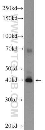 SLAIN1 Antibody in Western Blot (WB)