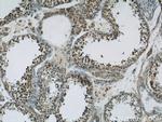 TBC1D1 Antibody in Immunohistochemistry (Paraffin) (IHC (P))