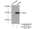 TBC1D1 Antibody in Immunoprecipitation (IP)