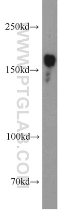 TBC1D1 Antibody in Western Blot (WB)