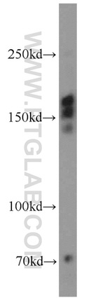 TBC1D1 Antibody in Western Blot (WB)